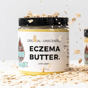 
                  
                    Load image into Gallery viewer, Eczema Butter (3 jar set)
                  
                
