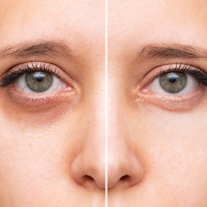 
                  
                    Load image into Gallery viewer, Dark Circles Concealer | Taylor Made Organics
                  
                