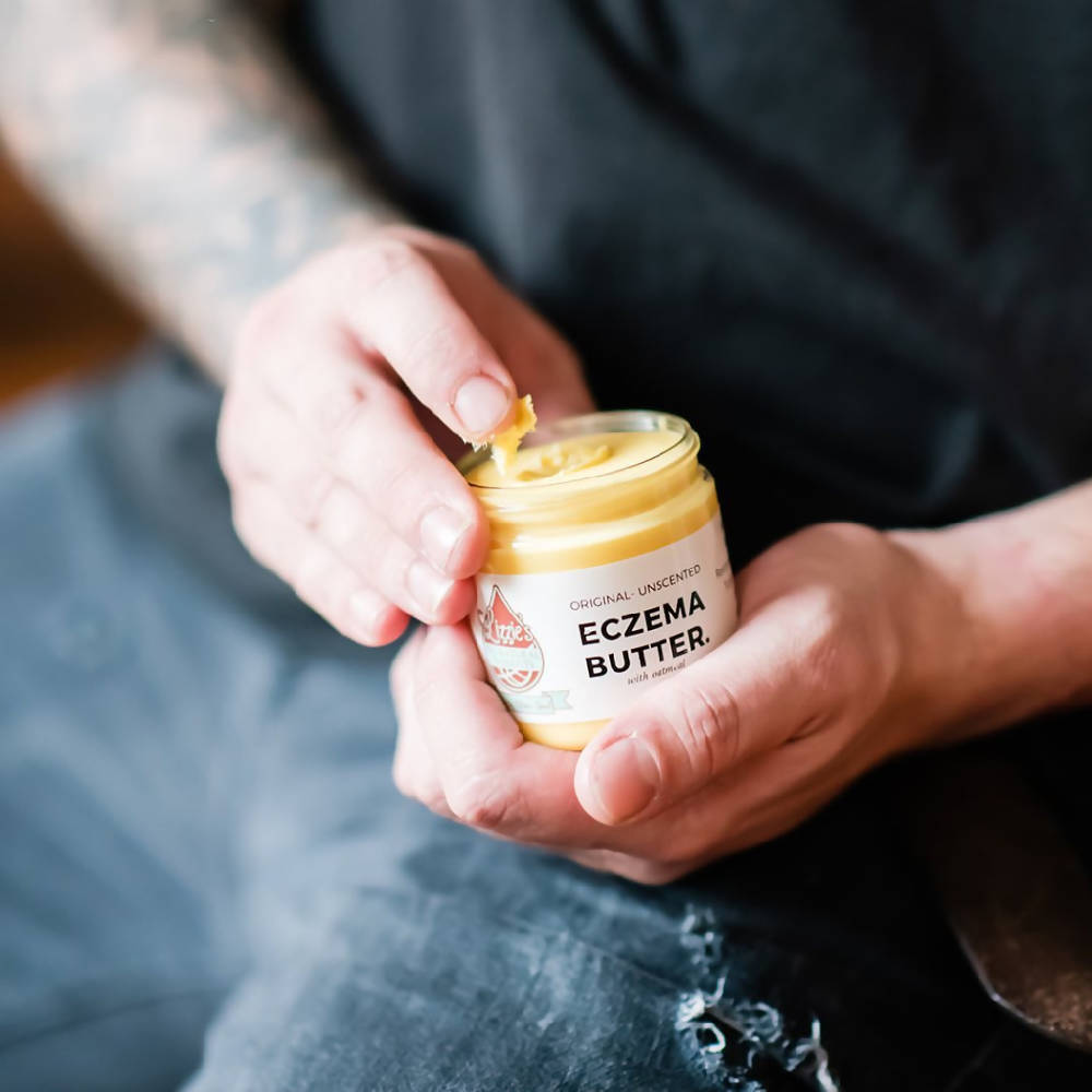 
                  
                    Load image into Gallery viewer, Eczema Butter (3 jar set)
                  
                